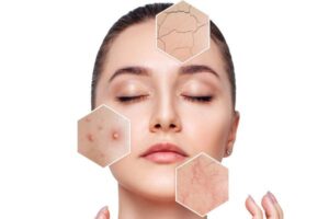 How to Identify Your Skin Type (Oily, Dry, Combination, and Sensitive)